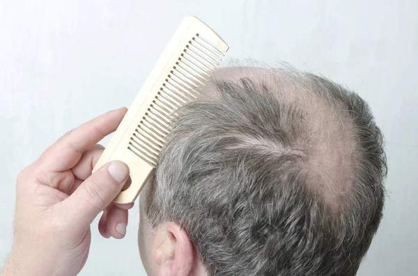 Closeup of bald back of head and wooden comb.Man doing his hair
