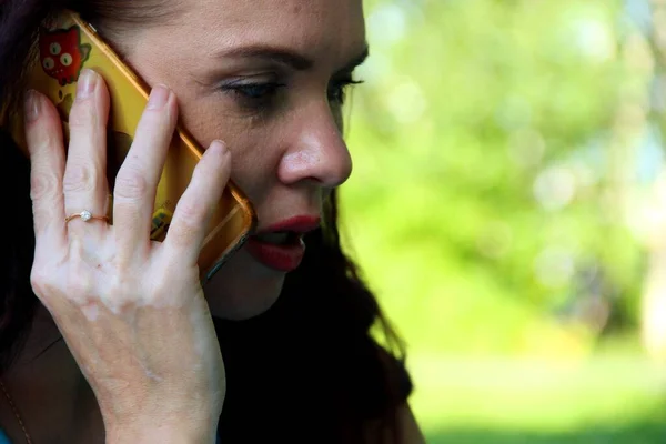 Turkuaz pantolonlu bir kadın yaz öğle vakti yeşil çimlerin üzerinde telefonla konuşuyor. Ellerinde vitiligo var.
