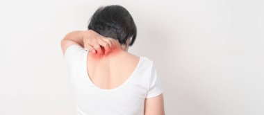 Böcek ısırığı ve yemek derisi iltihabından dolayı boynu kaşınan ve deri alerjisi için kaşınan yaşlı bir kadın. Dermatoloji, cüzzam günü, sistemik lupus eritematoz, sedef, urtikya ve isilik.