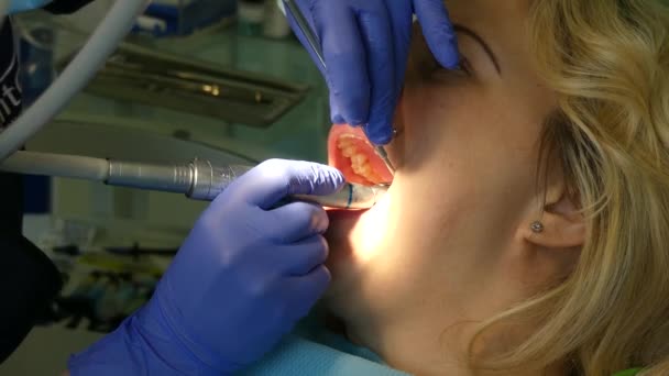 Kiev Ukraina April 2019 Flicka Receptionen Tandläkaren Tandläkare Behandlar Tänder — Stockvideo