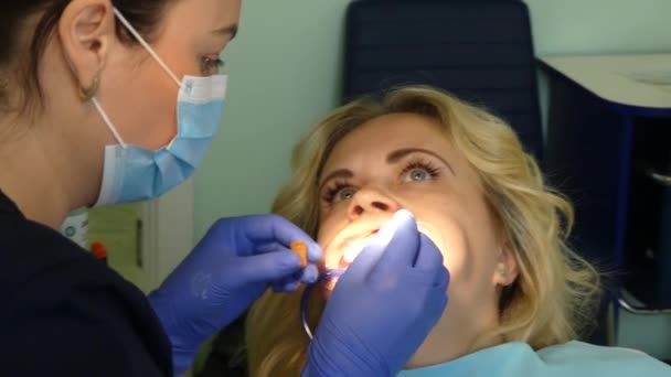 Kiev Ucrania Abril 2019 Niña Recepción Dentista Dentista Trata Los — Vídeo de stock