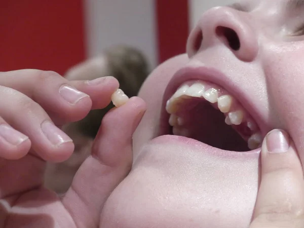 Un adolescente tenía un diente de leche. Adolescente tira de diente de leche . — Foto de Stock