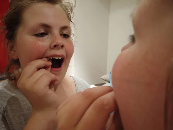 Teenager Had Milk Tooth Teen Pulls Milk Tooth — Stock Photo, Image