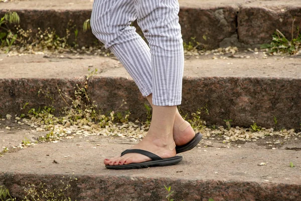 Frau Steht Sommer Auf Den Stufen Der Fotobeine Von Unten — Stockfoto