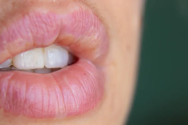 Aprire Bocca Femminile Una Giovane Ragazza Macro — Foto Stock