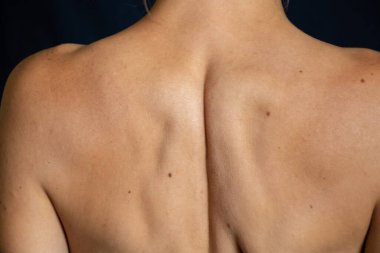 Elbiseleri olmayan ince bir kızın arka görüntüsü.