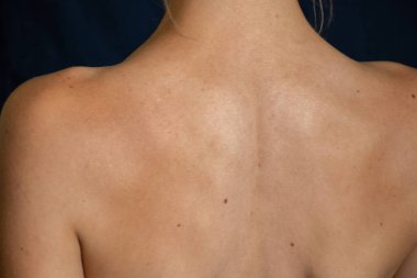 Elbiseleri olmayan ince bir kızın arka görüntüsü.