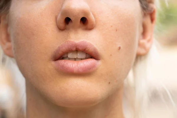 Labios Exuberantes Primer Plano Una Joven Luz Del Día Aire — Foto de Stock