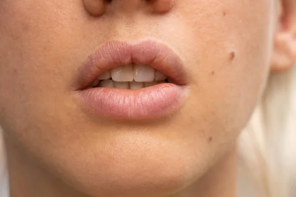 Labios Exuberantes Primer Plano Una Joven Luz Del Día Aire — Foto de Stock