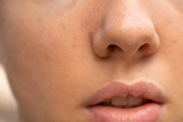 Üppige Lippen Nahaufnahme Eines Jungen Mädchens Bei Tageslicht Freien — Stockfoto