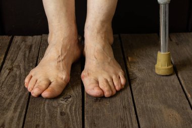 Yaşlı büyükannenin ayakları yerde, yakın planda.