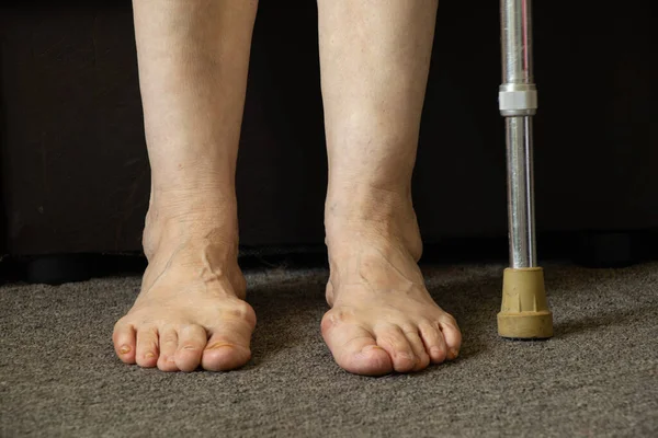 Piedi Della Vecchia Nonna Sul Pavimento Nella Sua Stanza Primo — Foto Stock