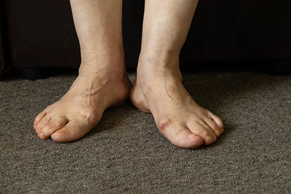 Yaşlı büyükannenin ayakları yerde, yakın planda.