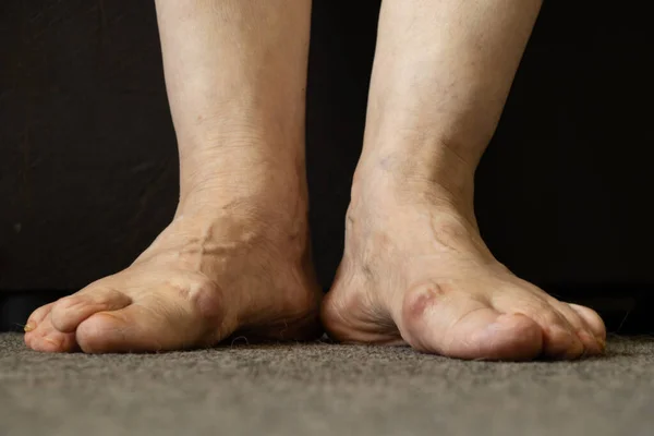 Piedi Della Vecchia Nonna Sul Pavimento Nella Sua Stanza Primo — Foto Stock