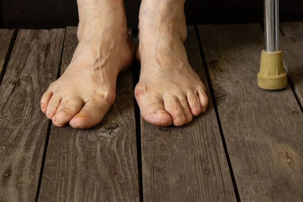 Yaşlı büyükannenin ayakları yerde, yakın planda.