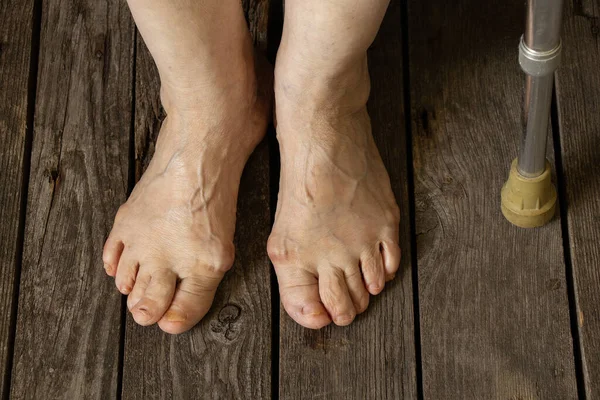 Nohy Staré Babičky Podlaze Svém Pokoji Zblízka — Stock fotografie