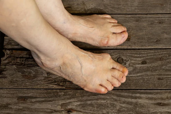 Nohy Staré Babičky Podlaze Svém Pokoji Zblízka — Stock fotografie