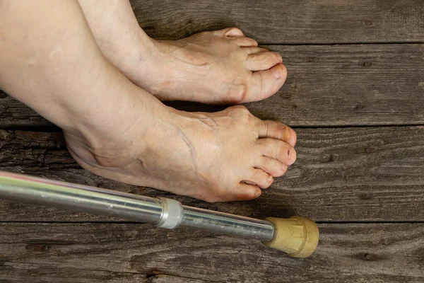 Yaşlı büyükannenin ayakları yerde, yakın planda.