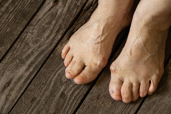 Piedi Della Vecchia Nonna Sul Pavimento Nella Sua Stanza Primo — Foto Stock