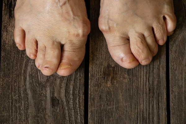 Yaşlı büyükannenin ayakları yerde, yakın planda.