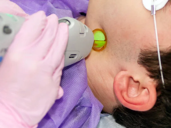 Ein Facharzt führt eine Laser-Haarentfernung auf der linken Seite der Schläfenregion durch — Stockfoto