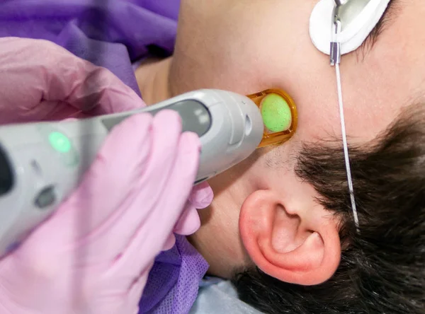 A medical specialist performs a laser hair removal procedure on the left side of the temporal region_2