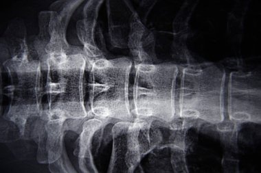 Genç bir kadının röntgeni.