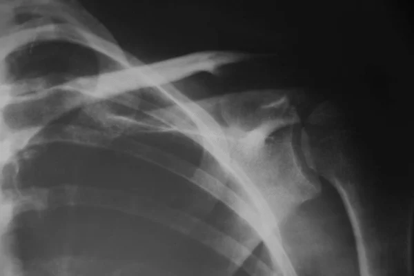 Röntgenbild Einer Jungen Frau — Stockfoto