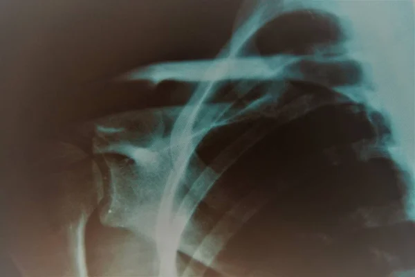 Genç Bir Kadının Röntgeni — Stok fotoğraf