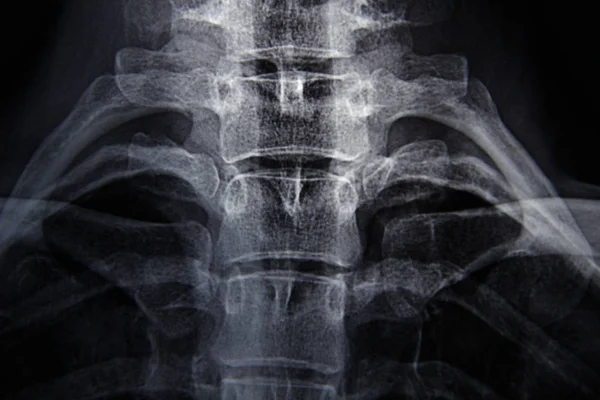 Genç bir kadının röntgeni.