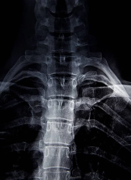 Genç bir kadının röntgeni.