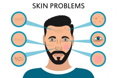 Erkek yüz cilt sorunları. 