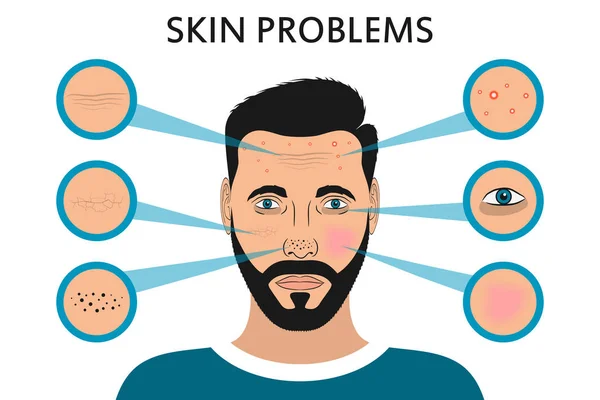 男性面部皮肤问题. — 图库矢量图片