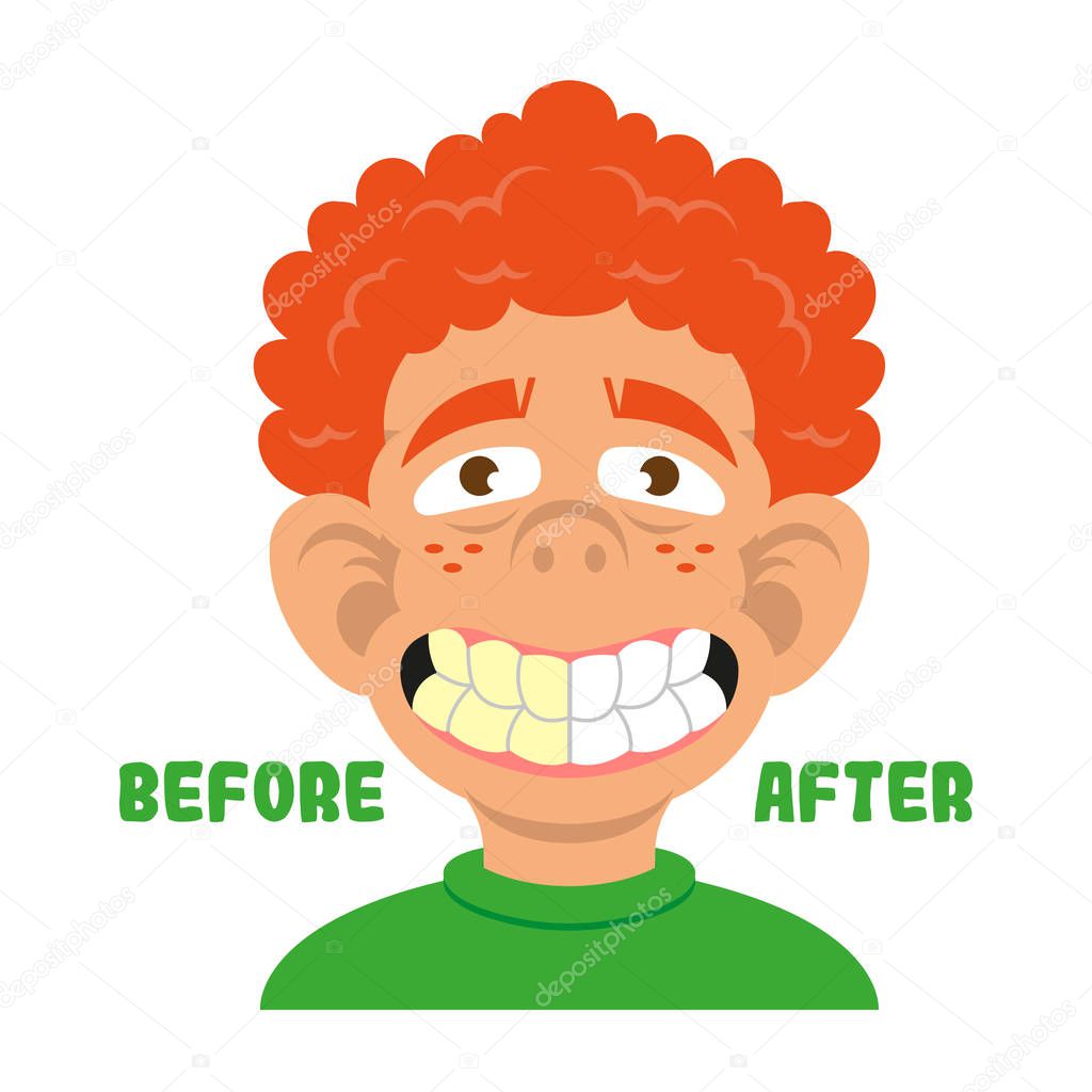 Boy show teeth before and after clean 