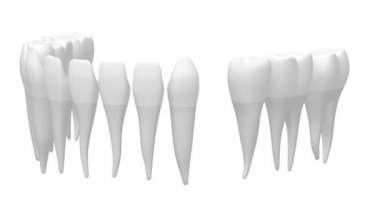 3D diş implant / diş protezi animasyon - beyaz arka plan üzerinde.
