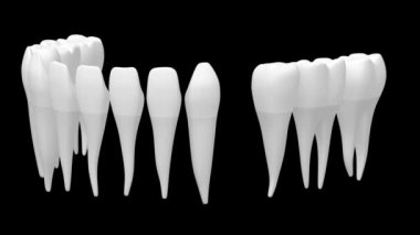 3D diş implant / diş protezi animasyon - siyah arka plan üzerine.