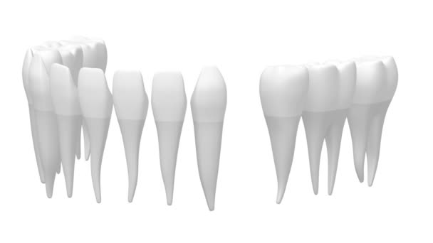Dental Implant Tand Implantaat Animatie Witte Achtergrond — Stockvideo