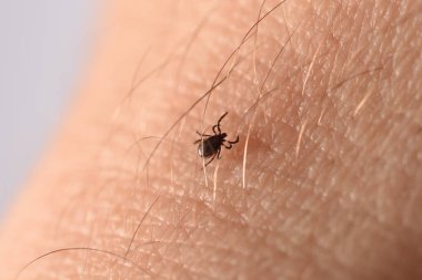 kene deriye tırmanıyor