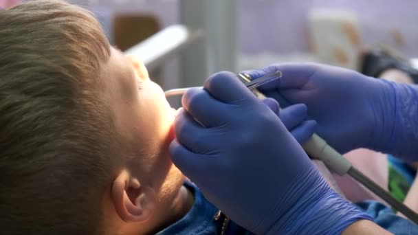 Menino Sentado Cadeira Dentista Bebê Bonito Abre Boca Para Dentista — Vídeo de Stock