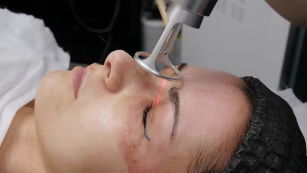 Fraktionierter Laserco2. kosmetischer Eingriff. Frau bei einer Laser-Hautbehandlung in einer Hautpflegeklinik, einer Wiederbelebungstechnik für Falten, Narben und Sonnenschäden an der Gesichtshaut. 4k — Stockvideo