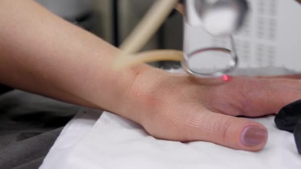 Laser fracionário CO2. Procedimento cosmético.Mulher tendo um tratamento de pele a laser em uma clínica de cuidados com a pele. Doutor fazendo um tratamento a laser em uma mão de mulher. Fecha. 4k — Vídeo de Stock