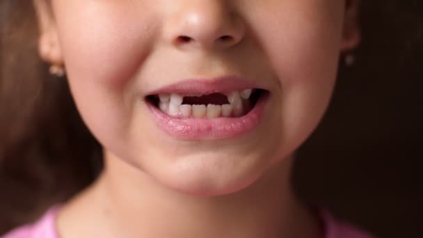 Dientes de bebé. Sonrisa desdentada. Cortar el diente de raíz. La chica abre los labios y no muestra dientes delanteros. De cerca. — Vídeos de Stock