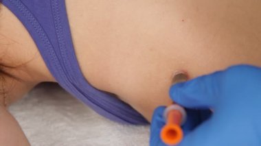 Doktorlar tıbbi eldivenleri getirip omzundaki yara izine bir şırınga yerleştirdiler..