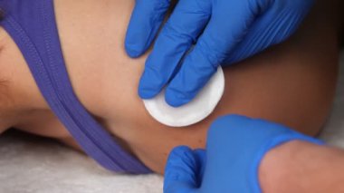 Doktorlar tıbbi eldiven verip yara izindeki sülüğü çıkarıyorlar. Yara izlerini silme prosedürü. Isırık bölgesinde kanama var..