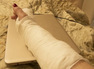 Bilek kırığı, tam dinlenme ve dizüstü bilgisayarda eğlence yok - hastalık, sakatlık 