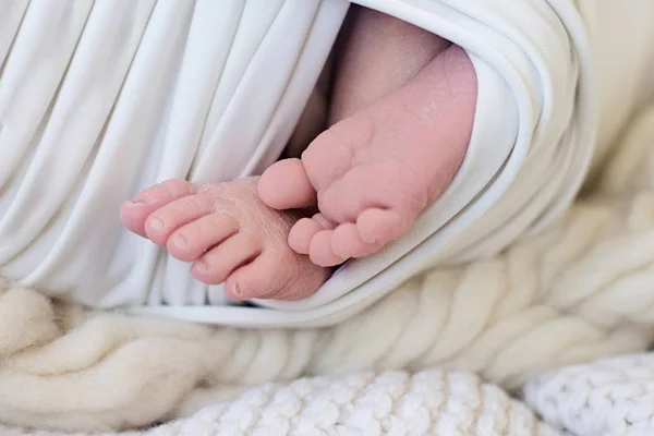 Los pies de un bebé recién nacido, los dedos de los pies y las uñas de las piernas de un niño, los primeros días de vida después del nacimiento, la piel escamosa —  Fotos de Stock