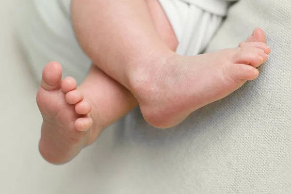 Pieds d'un nouveau-né, orteils dans les mains de maman et papa, mains et ongles d'un enfant, les premiers jours de la vie après la naissance, peau squameuse — Photo