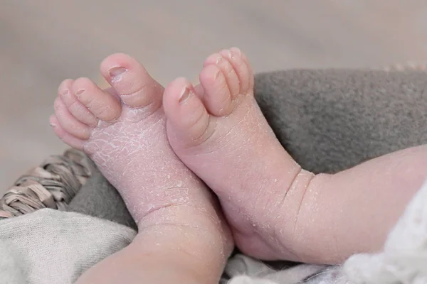 Feet of a newborn baby, toes  and nails of a child, the first days of life after birth, scaly skin, funny splayed toes