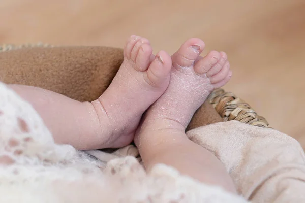 Ноги новорожденного ребенка, пальцы на ногах и ногтях ребенка, первые дни жизни после рождения, чешуйчатая кожа, смешные пальцы ног — стоковое фото