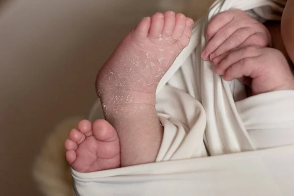 Nohy novorozence, prsty, ruce a nehty dítěte, první dny života po narození, šupinatá kůže — Stock fotografie